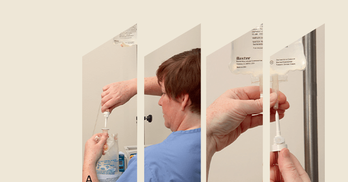 Cuidados de las vías intravenosas periféricas: regulación del caudal intravenoso y cambio de soluciones
