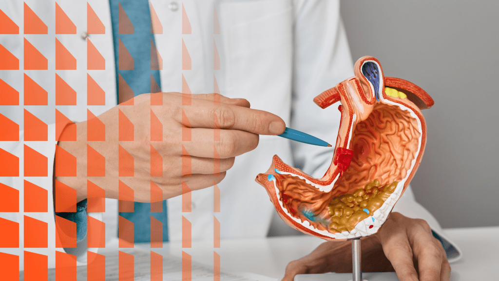 Estructura y tipos celulares de la mucosa gástrica.