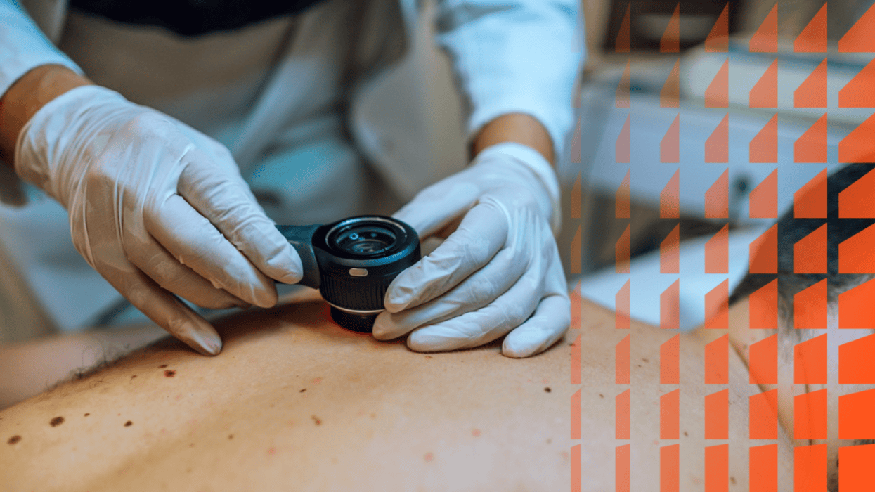 Raisonnement clinique : la dermatite atopique